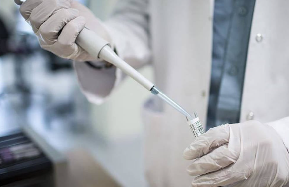 HIV’i Etkisiz Hale Getiren Antikor Keşfi
